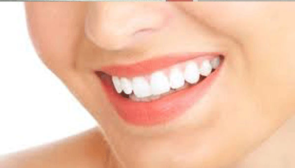 Cách kéo dài tuổi thọ cho răng sứ cercon