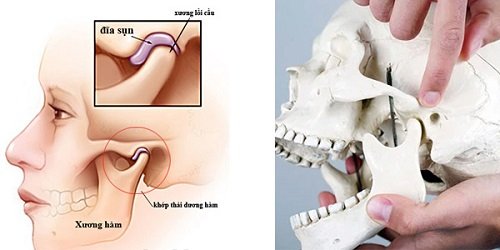 Khớp thái dương hàm 1