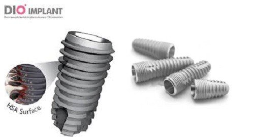 Các loại trụ Implant tại nha khoa hiện nay 3