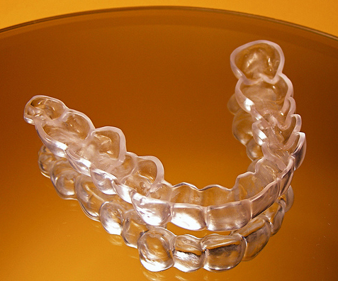 Niềng răng Invisalign là gì? 1