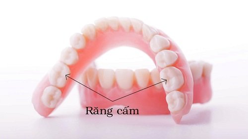 Trồng răng cấm hết bao nhiêu tiền? Tìm hiểu giá cả 1